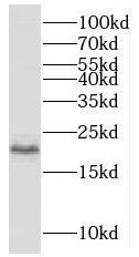 MCTS1 Antibody - BSA Free