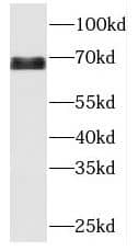 MBTD1 Antibody - BSA Free