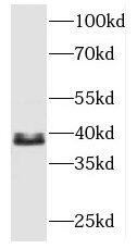 MBNL3 Antibody - BSA Free