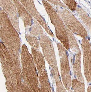 MBNL3 Antibody - BSA Free