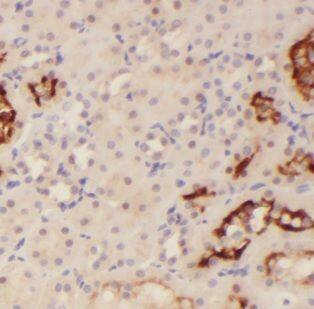 MAST3 Antibody - BSA Free