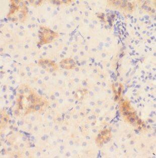 MARK4 Antibody - BSA Free