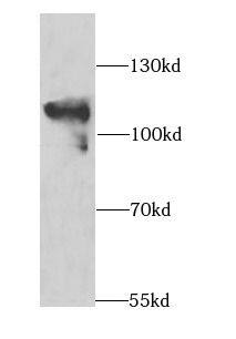 MAP4K3 Antibody - BSA Free
