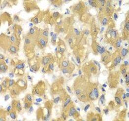MAP4K3 Antibody - BSA Free