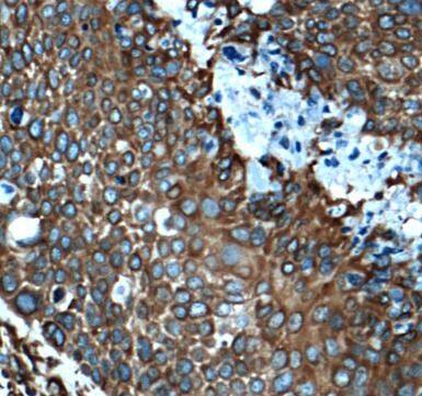 MAP4 Antibody - BSA Free