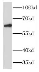 MANSC1 Antibody - BSA Free