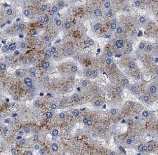 MAGT1 Antibody - BSA Free