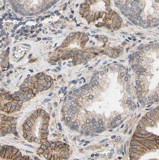 MAGEH1 Antibody - BSA Free