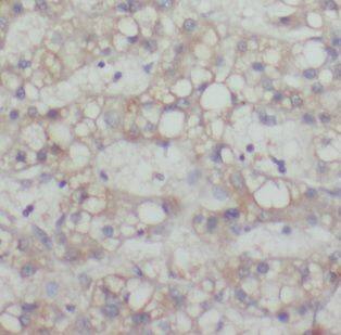 MAGEC3 Antibody - BSA Free