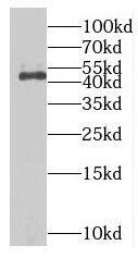 MAGEA8 Antibody - BSA Free