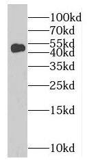 MAGEA11 Antibody - BSA Free