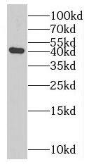 MAGEA10 Antibody - BSA Free