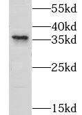 LYSMD3 Antibody - BSA Free
