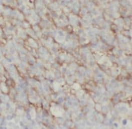 Ly6D Antibody - BSA Free