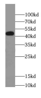 Cav1.2 Antibody - BSA Free