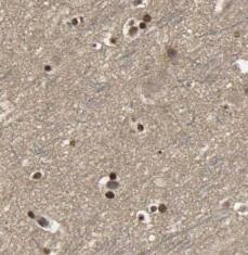 Cav1.2 Antibody - BSA Free