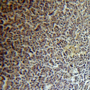 LSM7 Antibody - BSA Free