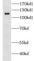 LRRC8D Antibody - BSA Free