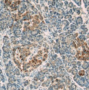 LRRC47 Antibody - BSA Free