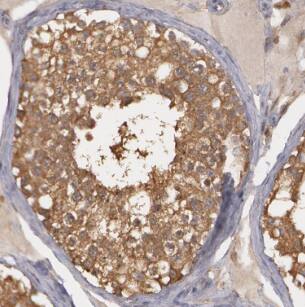 LRRC41 Antibody - BSA Free