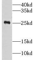 LRRC20 Antibody - BSA Free