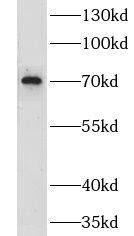 LRCH3 Antibody - BSA Free