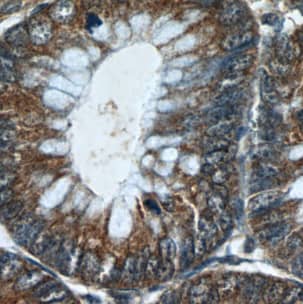 LRCH2 Antibody - BSA Free