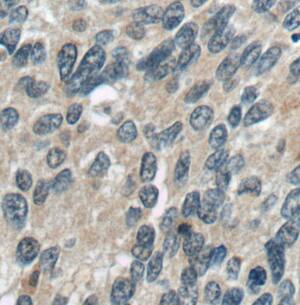 LRCH1 Antibody - BSA Free
