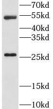 LRAT Antibody - BSA Free