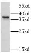 LPPR2 Antibody - BSA Free