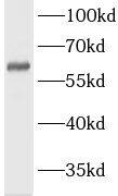 LMOD3 Antibody - BSA Free