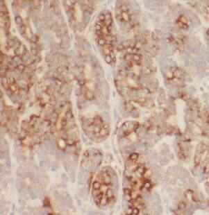 LMF1 Antibody - BSA Free