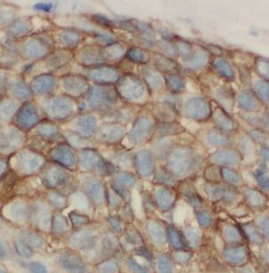 LIPC Antibody - BSA Free