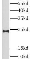 LIN7B Antibody - BSA Free