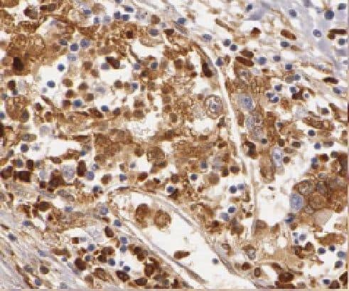 LIMD2 Antibody - BSA Free