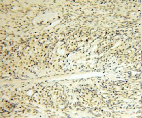 LDB1 Antibody - BSA Free