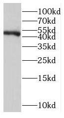 LDB1 Antibody - BSA Free