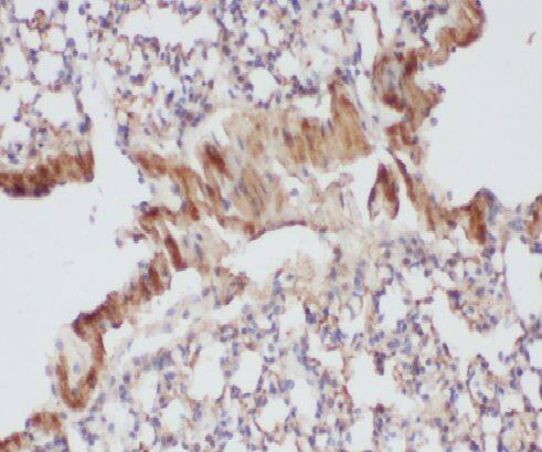 LCORL Antibody - BSA Free