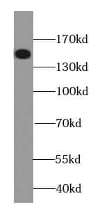 LATS2 Antibody - BSA Free