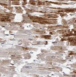 LATS2 Antibody - BSA Free