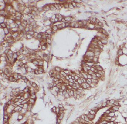 LARS Antibody - BSA Free