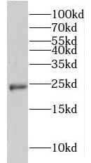LAPTM4B Antibody - BSA Free
