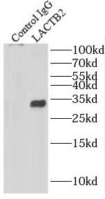 lactamase, beta 2 Antibody - BSA Free