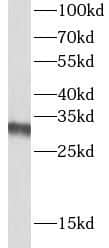 lactamase, beta 2 Antibody - BSA Free