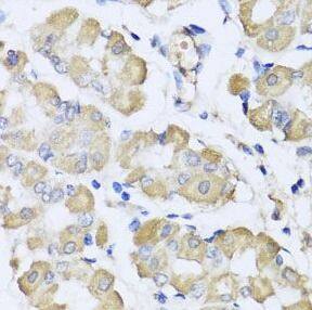 L2HGDH Antibody - BSA Free