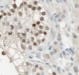 IFIT1B Antibody - BSA Free