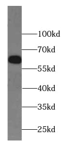 IFIT1B Antibody - BSA Free