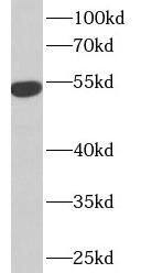 IFIT1 Antibody - BSA Free