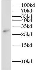 IDI2 Antibody - BSA Free
