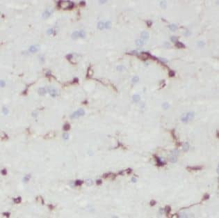 IDH3G Antibody - BSA Free